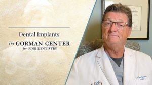 Thumbnail image of what you should know about Dental Implants